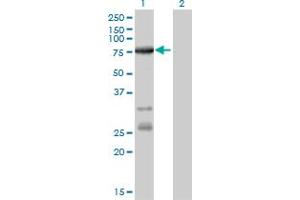 Image no. 4 for anti-Acyl-CoA Synthetase Long-Chain Family Member 5 (ACSL5) (AA 91-186) antibody (ABIN565656)