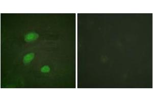 Immunofluorescence analysis of HeLa cells, using HIRA (Phospho-Thr555) Antibody.