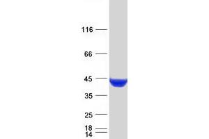 Image no. 1 for Cystathionase (Cystathionine gamma-Lyase) (CTH) (Transcript Variant 1) protein (Myc-DYKDDDDK Tag) (ABIN2712610)