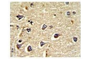 Image no. 3 for anti-Activated Leukocyte Cell Adhesion Molecule (ALCAM) (AA 58-87) antibody (ABIN3029841)