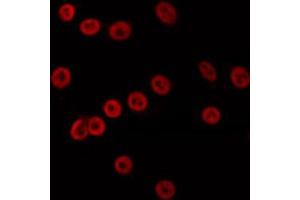 Image no. 1 for anti-MutL Homolog 3 (MLH3) antibody (ABIN6259107)