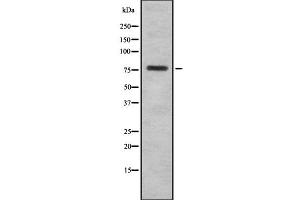 Image no. 1 for anti-Holliday Junction Recognition Protein (HJURP) (C-Term) antibody (ABIN6262279)