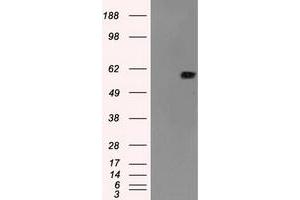 Image no. 2 for anti-Nuclear Receptor Binding Protein 1 (NRBP1) antibody (ABIN2727623)