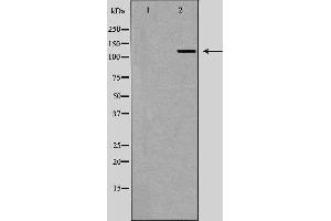 Image no. 1 for anti-UPF1 Regulator of Nonsense Transcripts Homolog (UPF1) antibody (ABIN6266288)