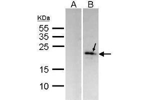 WB Image Western Blot analysis of MKP-6 expression in transfected 293T cell line (20ug of whole cell ltsate) A: Non-transfected lysate.