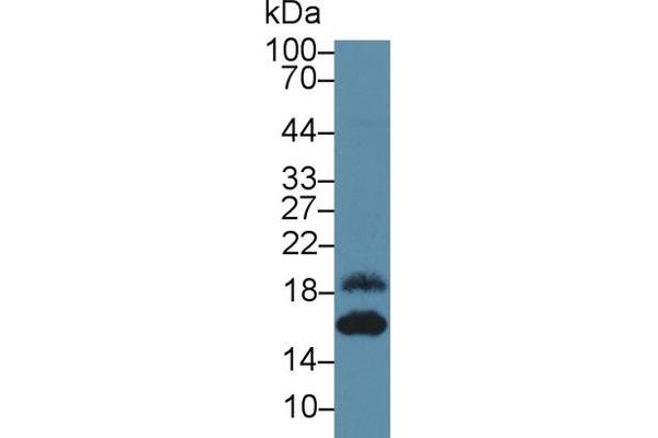 anti-Chemokine (C-X-C Motif) Ligand 5 (CXCL5) (AA 41-114) antibody