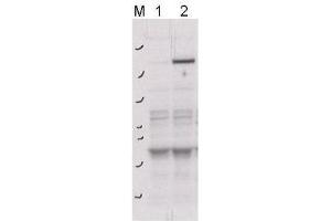 Image no. 1 for anti-rho-Associated, Coiled-Coil Containing Protein Kinase 2 (ROCK2) (pTyr256) antibody (ABIN233829)