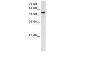 Image no. 1 for anti-Solute Carrier Family 25 (Mitochondrial Carrier, Phosphate Carrier), Member 25 (SLC25A25) (AA 71-120) antibody (ABIN6736655)