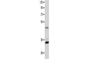Image no. 1 for anti-Melanocortin 1 Receptor (MC1R) antibody (ABIN2426175)