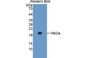 Image no. 2 for anti-Phospholipase A2, Group X (PLA2G10) (AA 32-165) antibody (ABIN1869839)