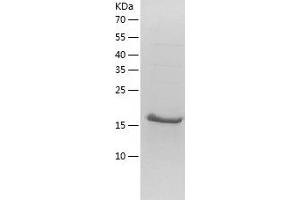 NUDT4 Protein (AA 1-180) (His tag)