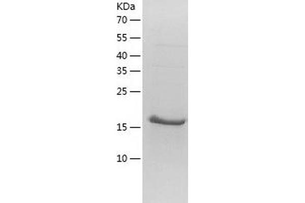 NUDT4 Protein (AA 1-180) (His tag)