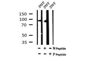 Image no. 2 for anti-Cullin 4B (CUL4B) (pThr48) antibody (ABIN6269583)