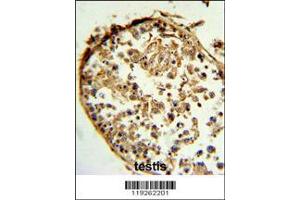 Image no. 3 for anti-Cathepsin S (CTSS) (AA 210-240) antibody (ABIN391571)