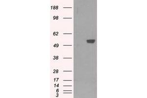 Image no. 1 for anti-6-phosphofructo-2-Kinase/fructose-2,6-Biphosphatase 4 (PFKFB4) antibody (ABIN2728750)