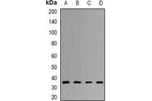 Image no. 2 for anti-Ubiquitin Carboxyl-terminal Hydrolase L5 (UCHL5) antibody (ABIN2967129)