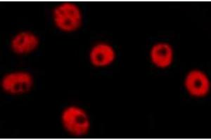 Image no. 4 for anti-Vacuolar Protein Sorting 72 Homolog (S. Cerevisiae) (VPS72) antibody (ABIN6258354)