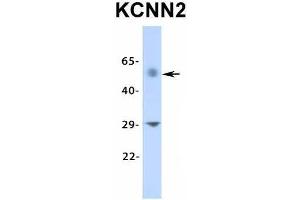 Image no. 5 for anti-Potassium Intermediate/small Conductance Calcium-Activated Channel, Subfamily N, Member 2 (KCNN2) (Middle Region) antibody (ABIN2776295)