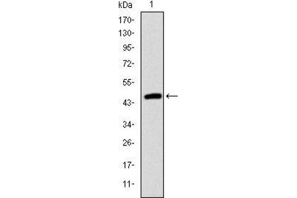 TNNI2 antibody