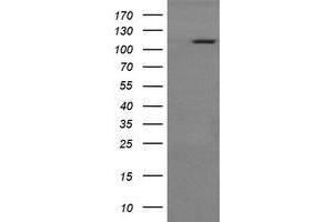 Image no. 2 for anti-RAS P21 Protein Activator (GTPase Activating Protein) 1 (RASA1) antibody (ABIN1500606)