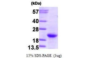 GTPase NRas Protein (NRAS) (AA 1-186)
