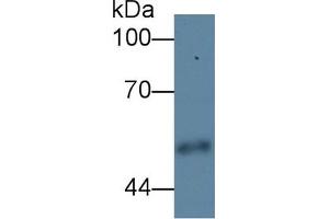 Image no. 2 for Carboxypeptidase E (CPE) ELISA Kit (ABIN6730971)