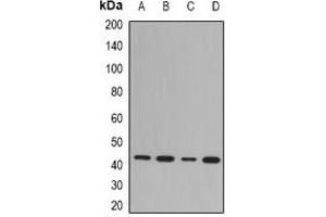 Image no. 2 for anti-N-Myc Downstream Regulated 1 (NDRG1) antibody (ABIN3198216)