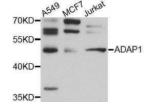 Image no. 1 for anti-ArfGAP with Dual PH Domains 1 (ADAP1) antibody (ABIN1678570)