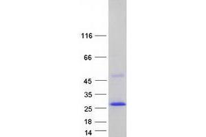 Image no. 1 for Sarcospan (Kras Oncogene-Associated Gene) (SSPN) (Transcript Variant 2) protein (Myc-DYKDDDDK Tag) (ABIN2731403)