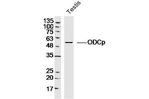 Image no. 1 for anti-Arginine Decarboxylase (ADC) (AA 51-150) antibody (ABIN5675428)