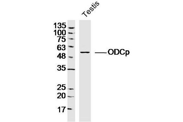 ADC Antikörper  (AA 51-150)