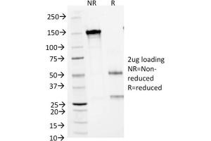 Image no. 4 for anti-Arginase, Liver (ARG1) (AA 11-97) antibody (ABIN6939857)