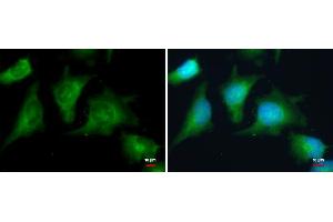 ICC/IF Image PRKAR2A antibody detects PRKAR2A protein at cytoplasm by immunofluorescent analysis.