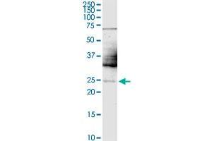 Image no. 5 for anti-Twist Homolog 1 (Drosophila) (TWIST1) (AA 100-202) antibody (ABIN563296)