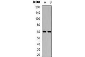 Image no. 1 for anti-Cholinergic Receptor, Muscarinic 5 (CHRM5) antibody (ABIN2957529)