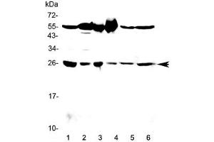 Image no. 2 for anti-Glutathione S-Transferase mu 3 (Brain) (GSTM3) antibody (ABIN5708464)