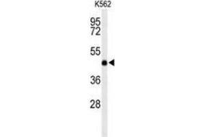 Image no. 4 for anti-Lecithin-Cholesterol Acyltransferase (LCAT) (AA 292-321), (Middle Region) antibody (ABIN953145)