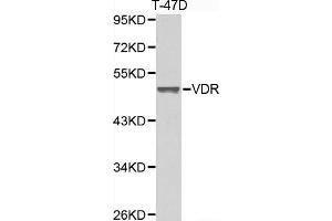 Image no. 3 for anti-Vitamin D Receptor (VDR) antibody (ABIN3023181)