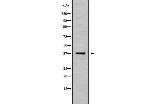 OR52B6 antibody  (Internal Region)