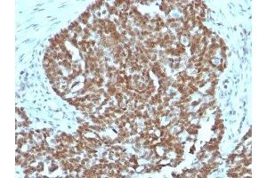 Image no. 3 for anti-Nucleolin (NCL) antibody (ABIN3025715)