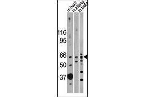 Image no. 2 for anti-Activin A Receptor, Type IIB (ACVR2B) (AA 1-30) antibody (ABIN391162)