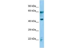 Image no. 1 for anti-Alcohol Dehydrogenase 7 (Class IV), mu Or sigma Polypeptide (ADH7) (C-Term) antibody (ABIN2776994)