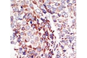 Image no. 5 for anti-TEK Tyrosine Kinase, Endothelial (TEK) (AA 758-789) antibody (ABIN3029103)