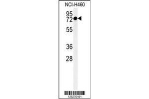 Western Blotting (WB) image for anti-Coiled-Coil Domain Containing 62 (CCDC62) antibody (ABIN2158083)