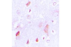 Image no. 2 for anti-Holocytochrome C Synthase (HCCS) (Center) antibody (ABIN2706292)