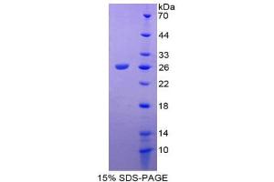 Image no. 1 for Tachykinin Receptor 2 (TACR2) (AA 1-200) protein (His tag) (ABIN2126910)