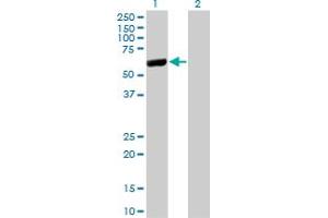 Image no. 2 for anti-Cytosol Aminopeptidase (LAP3) (AA 420-519) antibody (ABIN526425)