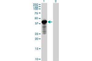 Image no. 1 for anti-Homer Homolog 2 (HOMER2) (AA 1-343) antibody (ABIN522914)