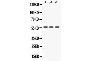 Image no. 1 for anti-Aldehyde Dehydrogenase 1 Family, Member B1 (ALDH1B1) (AA 116-156), (N-Term) antibody (ABIN4886450)