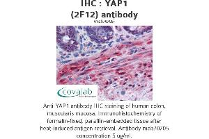 Image no. 2 for anti-Yes-Associated Protein 1 (YAP1) (AA 53-162) antibody (ABIN1723562)